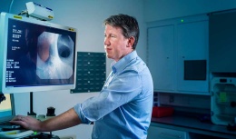 Influencing NHS policy on lung cancer screening
