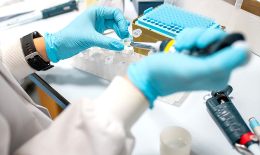 Test tubes in a lab